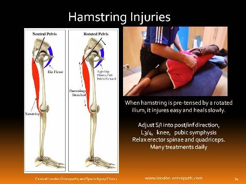 Hamstring Injuries – Incidence and Treatment - The Training Room